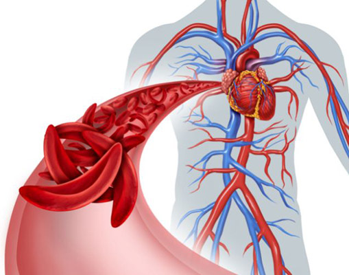 An illustration of blood circulation in all areas of the body